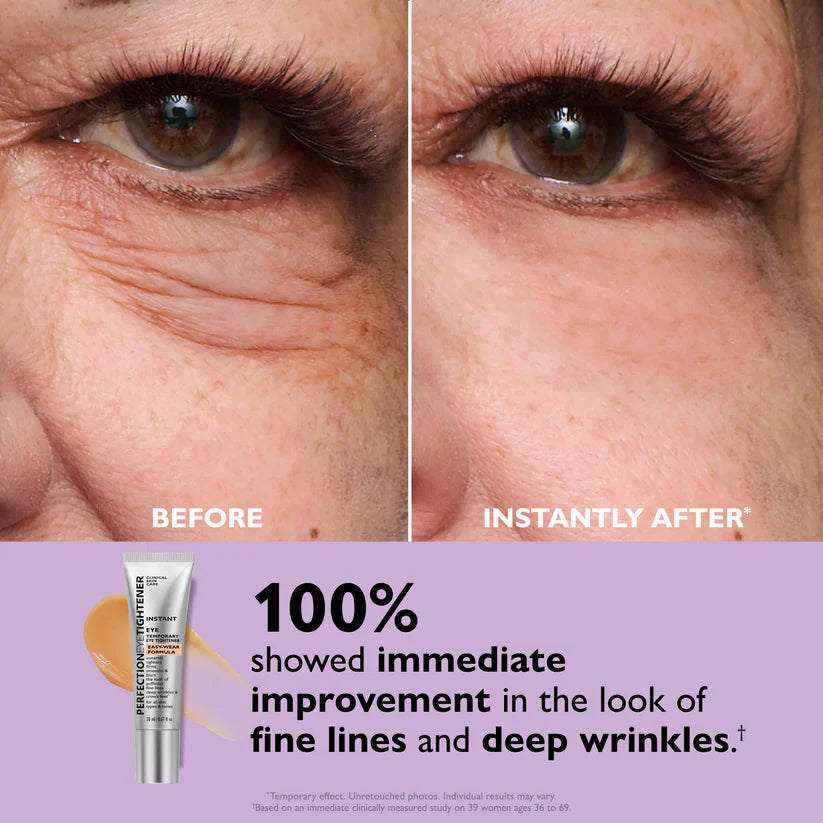 ✨Instant Wrinkle Eye Tightener Cream (FREE BONUS BRUSH)