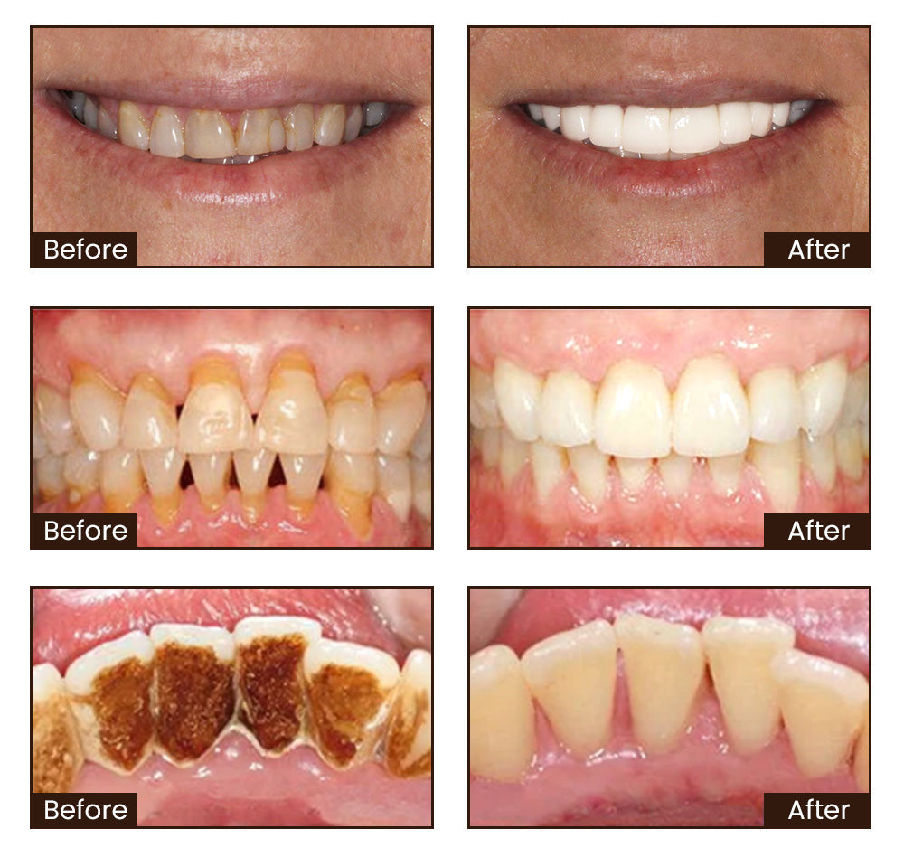 Nexisify® Vitamin B3 Whitening Toothpaste
