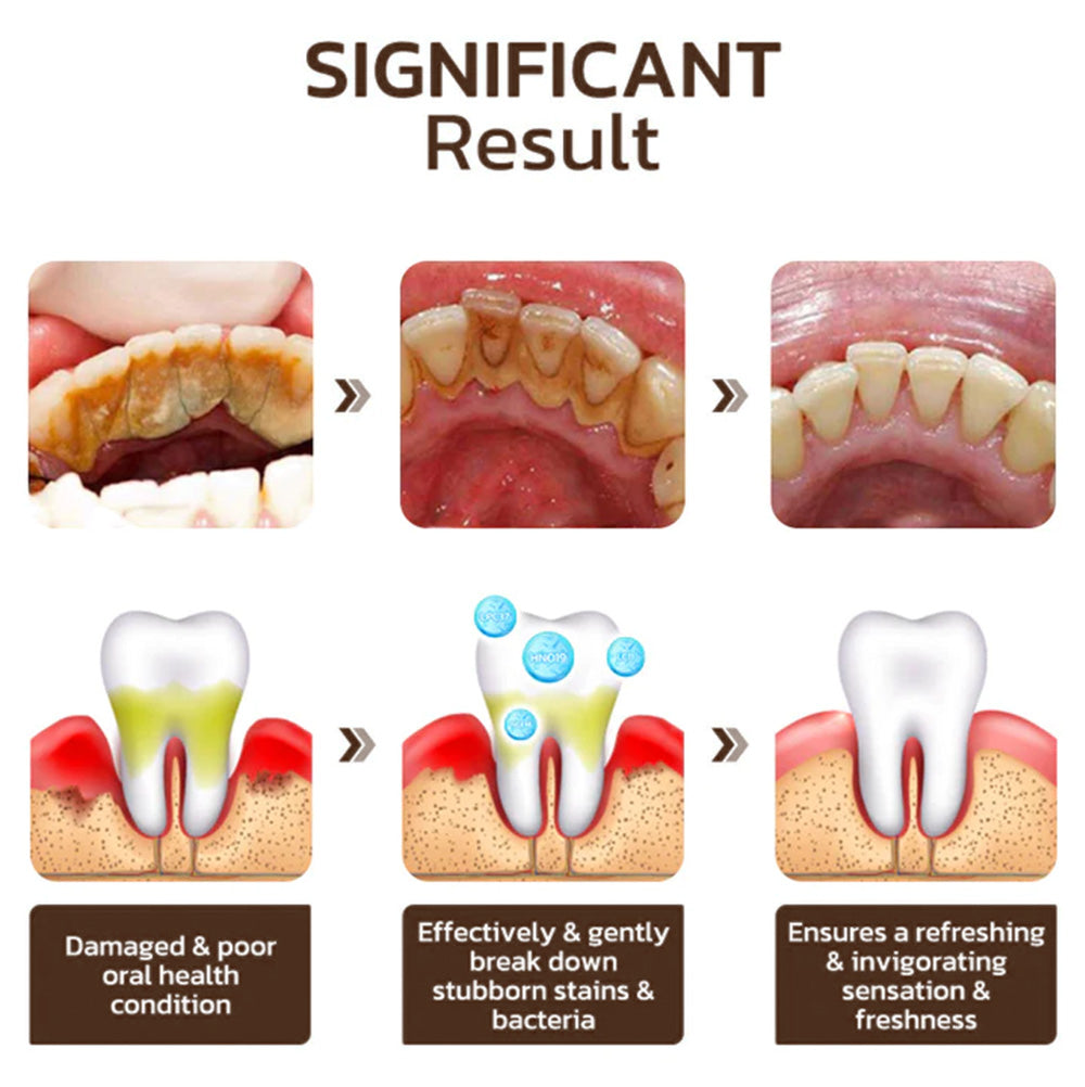 Nexisify® Vitamin B3 Whitening Toothpaste