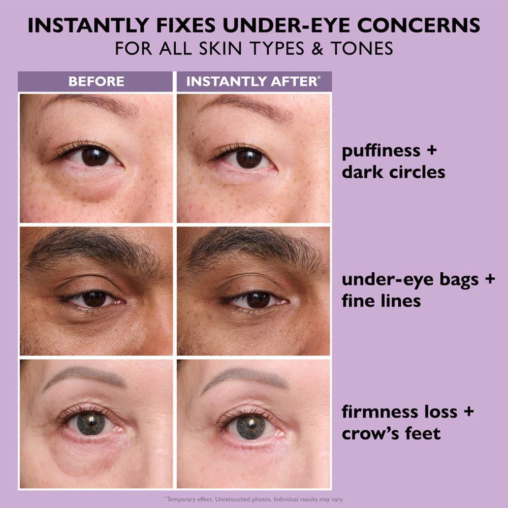 ✨Instant Wrinkle Eye Tightener Cream  (FREE BONUS BRUSH)