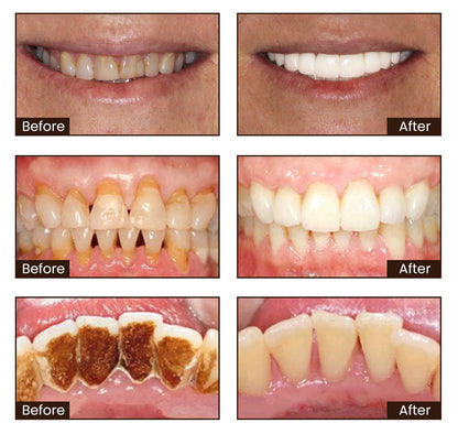 Nexisify® Vitamin B3 Whitening Toothpaste